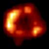 Supernova 1987A